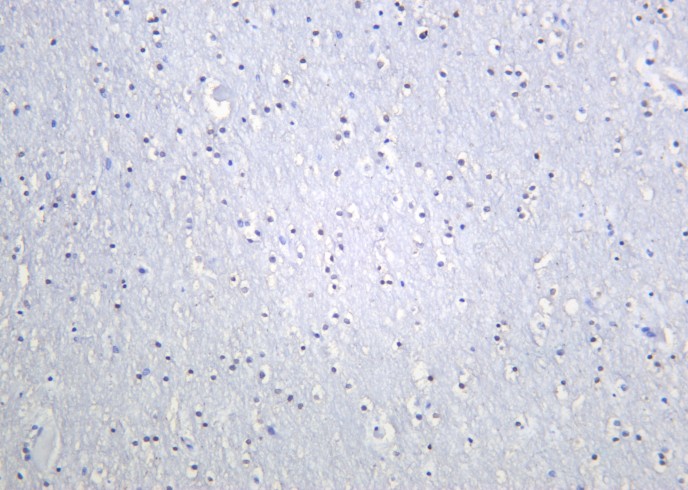 Recombinant OLIG2 Monoclonal Antibody - small - 2