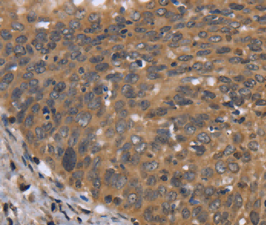 FGFR1OP Polyclonal Antibody - 3