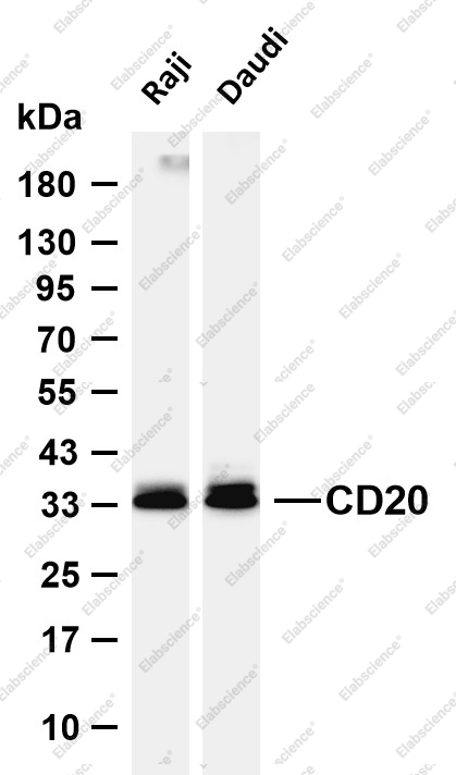 Recombinant Keratin 20 Monoclonal Antibody - 1