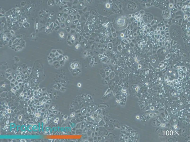HARA-B Cell Complete Medium - 3