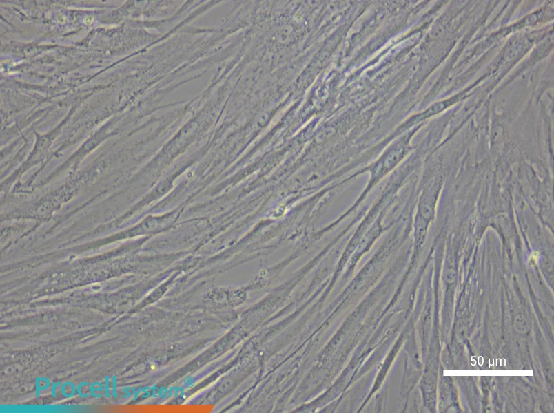 Human Glomerular Mesangial Cell Complete Medium - small - 6