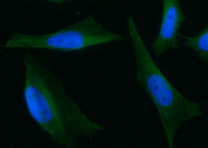 ARD1 Monoclonal Antibody-searchlist-1