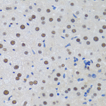 Immunohistochemistry of paraffin-embedded Rat liver using MTA3 Polyclonal Antibody at dilution of 1:100 (40x lens).
