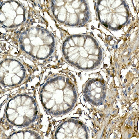 Immunohistochemistry of paraffin-embedded human colon using NEUROG3 Polyclonal Antibody at dilution of 1:200 (40x lens).Perform high pressure antigen retrieval with 10 mM citrate buffer pH 6.0 before commencing with IHC staining protocol.