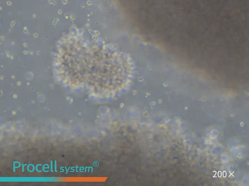 GM23687 Cell Complete Medium - 6