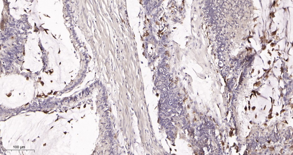 Recombinant Bcl-XL Monoclonal Antibody - small - 2