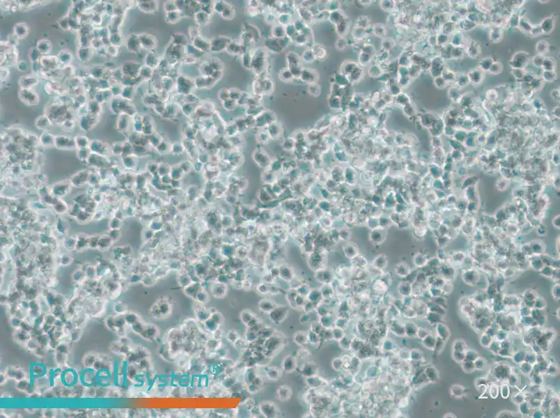 SK-NEP-1 Cell Complete Medium - 4