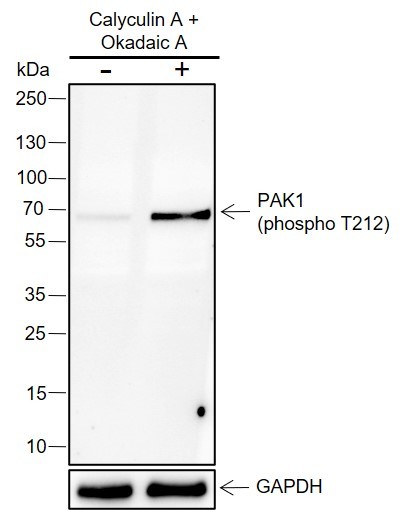 Recombinant Phospho-PAK1 (Thr212) Monoclonal Antibody - 3