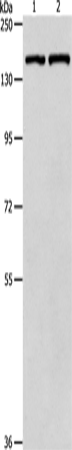 Western Blot analysis of Hela cell and Mouse lung tissue using PTCH1 Polyclonal Antibody at dilution of 1:900