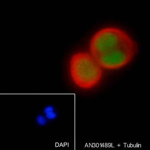 Recombinant CENP-A Monoclonal Antibody - small - 5