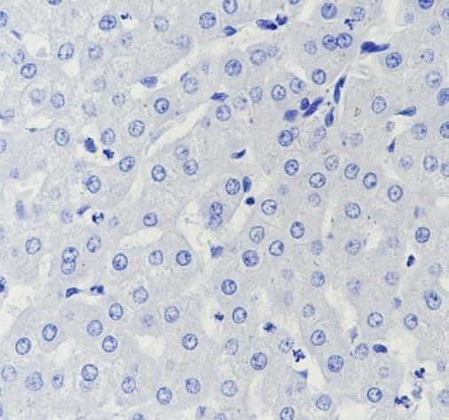 Recombinant CPT1B Monoclonal Antibody - small - 5