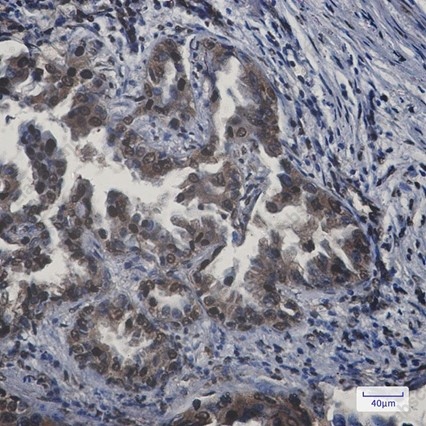 Recombinant APPL1 Monoclonal Antibody - 2