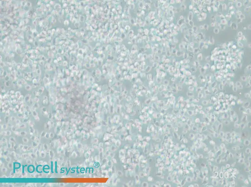 CCRF-SB Cell Complete Medium - 4