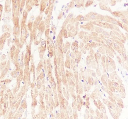 Recombinant NF-kB2 p100/p52 Monoclonal Antibody - small - 4
