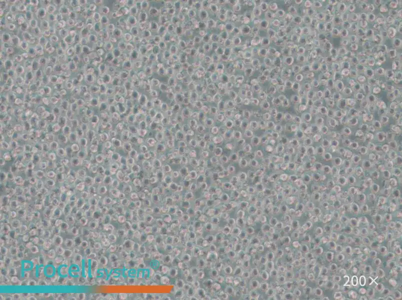 OCI-AML-3 Cell Complete Medium - small - 5