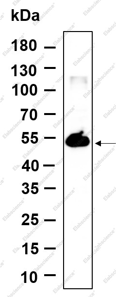 Recombinant TMEM161B Monoclonal Antibody - 1