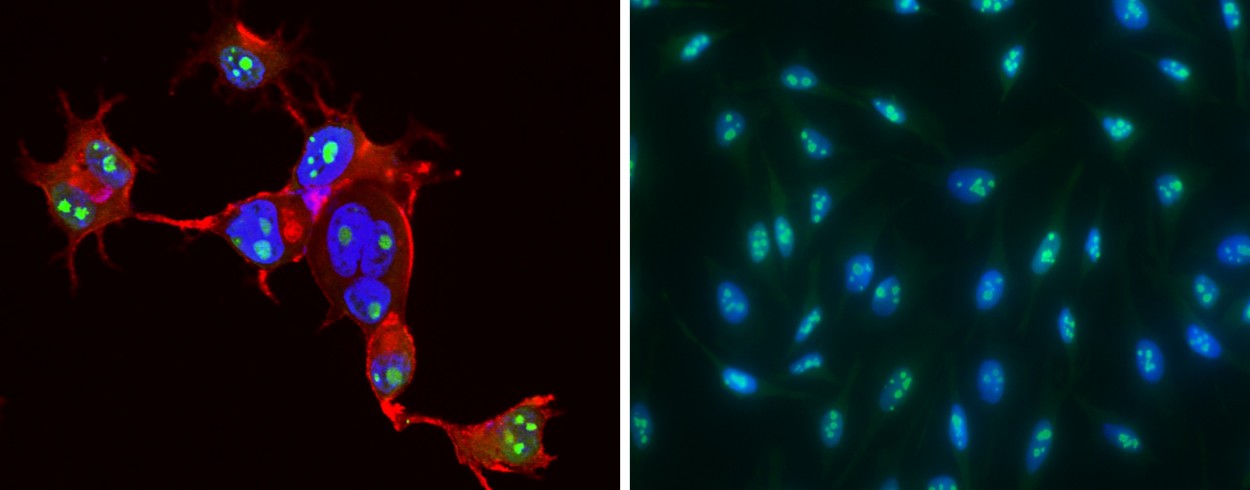 CCNE1/Cyclin-E1 Monoclonal Antibody-searchlist-1
