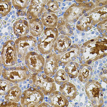 Immunohistochemistry of paraffin-embedded Rat kidney using FAK Polyclonal Antibody at dilution of 1:100 (40x lens).