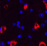 Immunofluorescence analysis of Mouse brain tissue using MAP2 Monoclonal Antibody at dilution of 1:200.