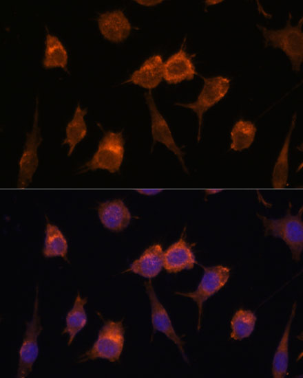 Immunofluorescence analysis of L929 cells using AVIL Polyclonal Antibody at dilution of  1:100. Blue: DAPI for nuclear staining.