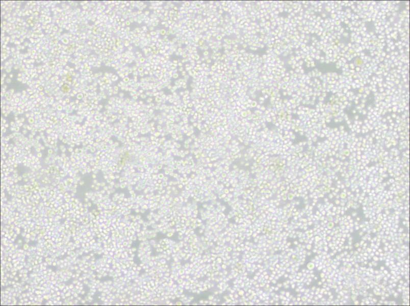 P3X63Ag8 Cell Complete MediumP3X63Ag8 Cell Complete Medium - 3