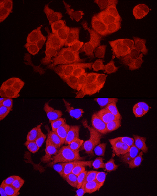 Immunofluorescence analysis of MCF7 cells using TREX1 Polyclonal Antibody at dilution of 1:50 (40x lens). Blue: DAPI for nuclear staining.