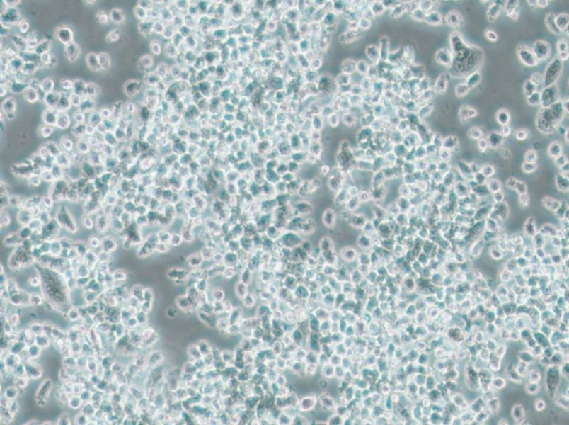KMS-11 Cell Complete Medium - 5