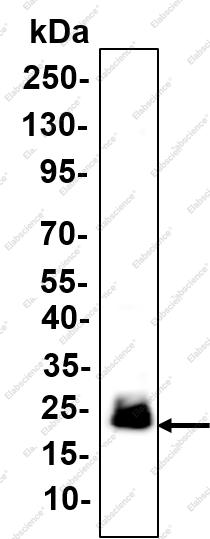 Recombinant NGAL Monoclonal Antibody - 1