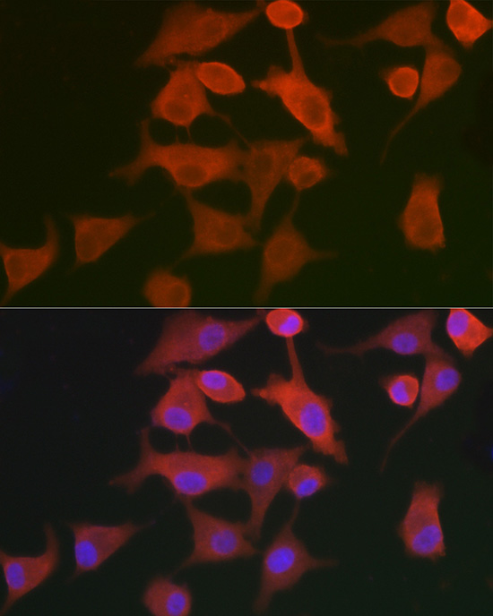 Immunofluorescence analysis of A-549 cells using AHNAK Polyclonal Antibody at dilution of 1:100. Blue: DAPI for nuclear staining.