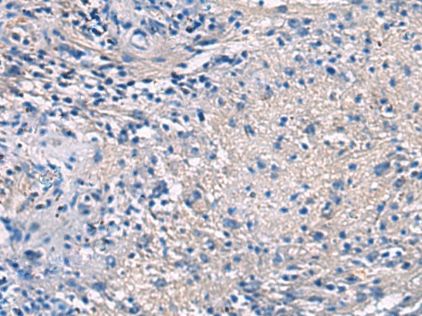 Immunohistochemistry of paraffin-embedded Human brain tissue  using PROKR2 Polyclonal Antibody at dilution of 1:40(?200)