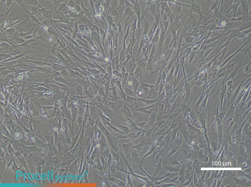 Human Umbilical Cord Mesenchymal Stem Cell Complete Medium - 2