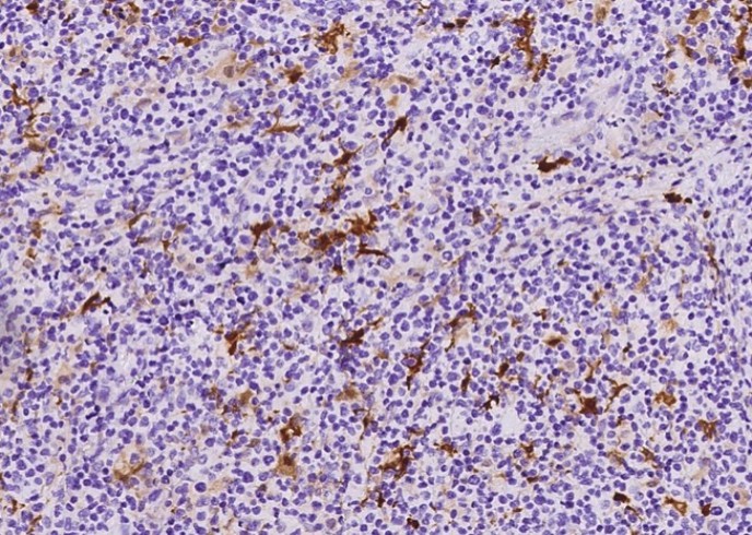 Recombinant S100B Monoclonal Antibody - small - 3