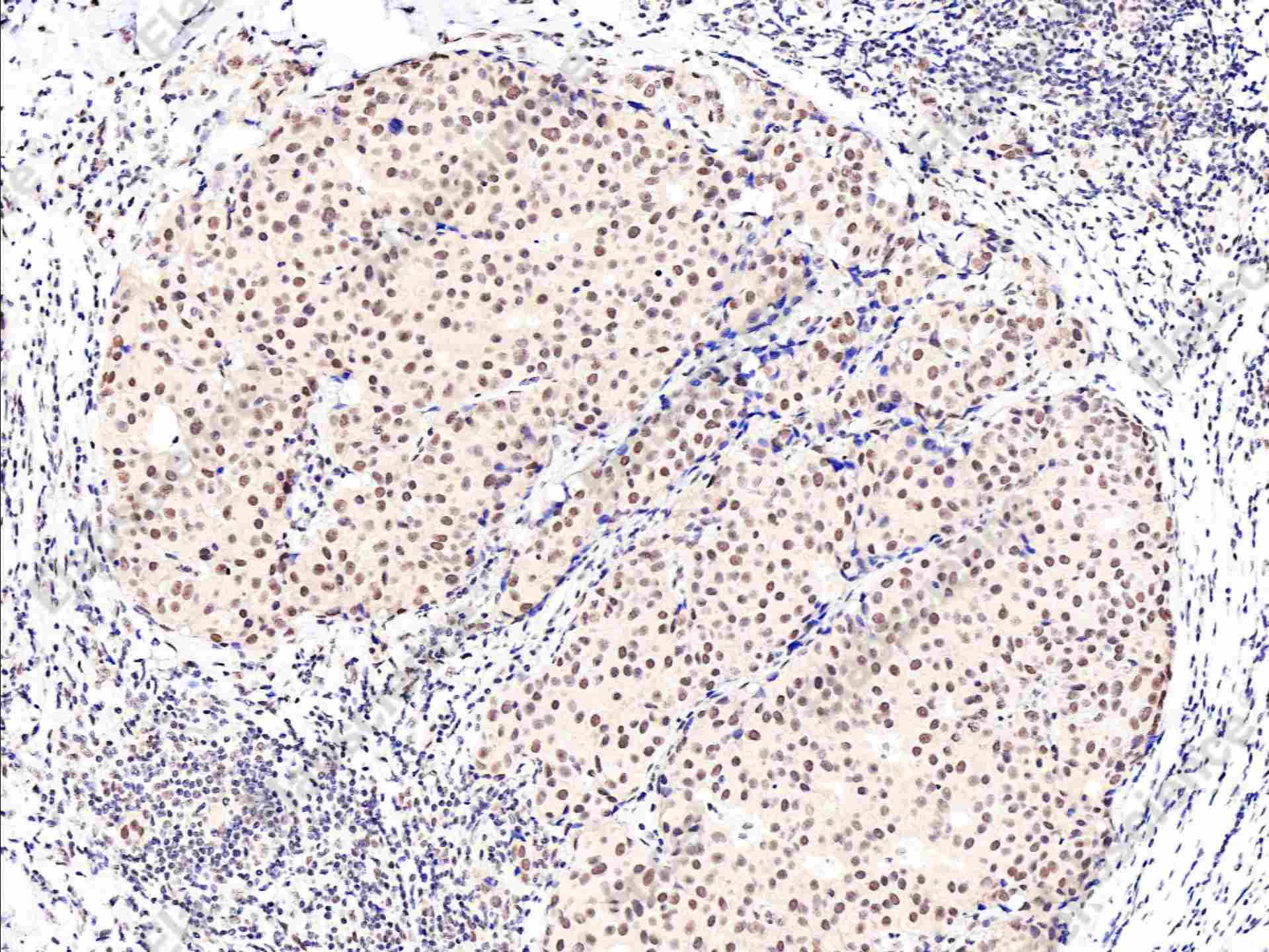 Recombinant Phospho-AKT1 (Thr450) Monoclonal Antibody - 1