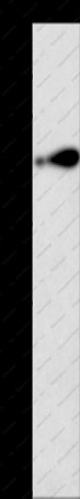 RAGE Polyclonal Antibody - 1