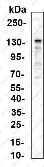 Recombinant Tyk2 (Phospho Tyr1054/1055) Monoclonal Antibody - 1