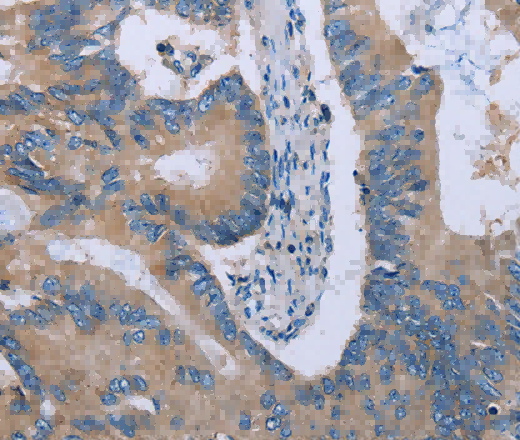 HYAL3 Polyclonal Antibody - 3