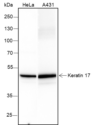 Recombinant Keratin 17 Monoclonal Antibody-searchlist-1