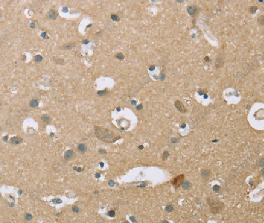 ECHS1 Polyclonal Antibody - 3