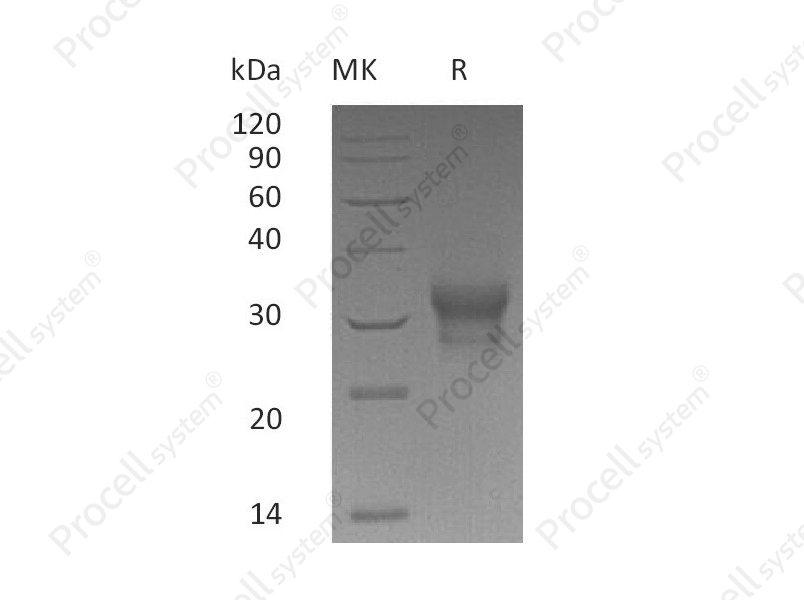 IFN-&lambda;1/IL-29 (C-10His), Human, Recombinant