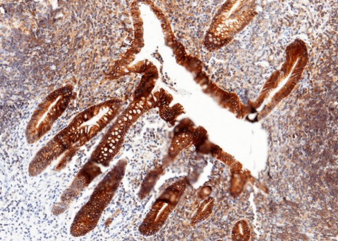 Recombinant Cadherin-17/LI-cadherin/CDH17 Monoclonal Antibody - small - 3