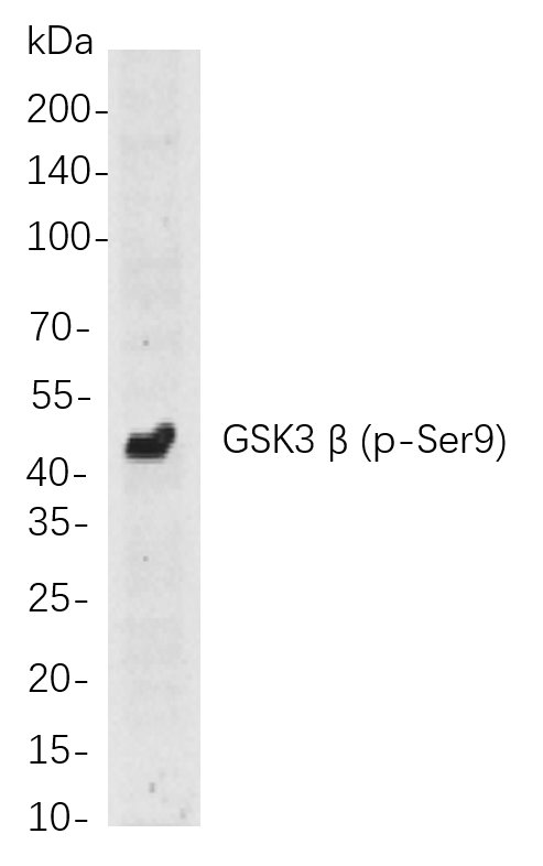 Recombinant Phospho-GSK3 β (Ser9) Monoclonal Antibody-searchlist-1