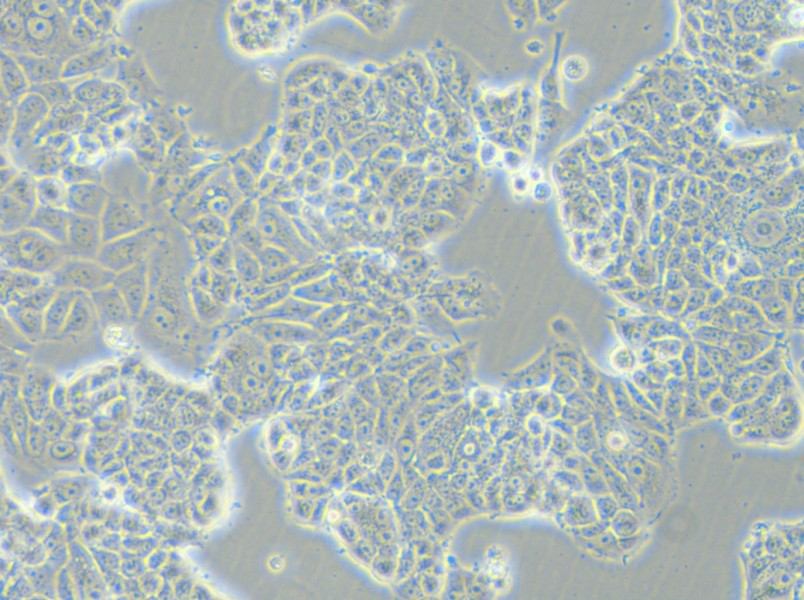 MCF-7-FLUC Cell Complete Medium - 5