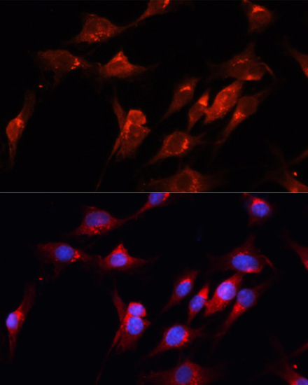 Immunofluorescence analysis of C6 cells using CUX1 Polyclonal Antibody at dilution of  1:100. Blue: DAPI for nuclear staining.