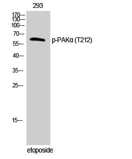 Western Blot analysis of 293T cells with Phospho-PAK1 (Thr212) Polyclonal Antibody