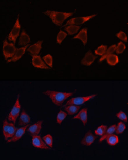 Immunofluorescence analysis of HeLa cells using HO-1 Polyclonal Antibody at dilution of  1:100 (40x lens). Blue: DAPI for nuclear staining.