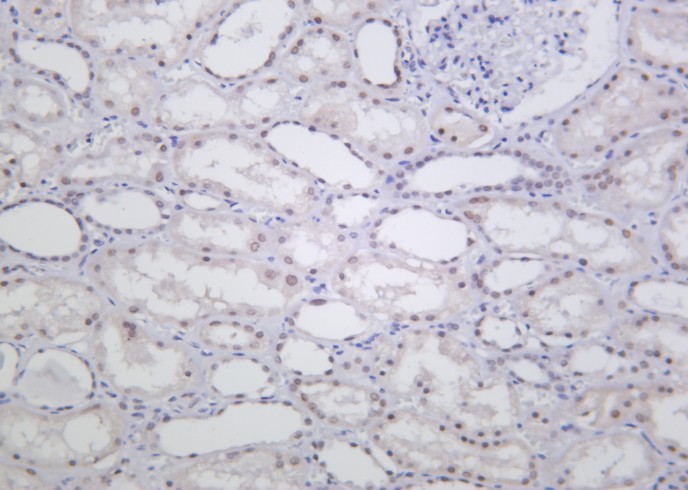 Recombinant ALKBH5 Monoclonal Antibody-searchlist-1