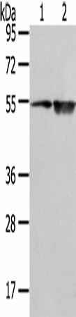 Western Blot analysis of TM4 cell and Human placenta tissue using EAAT3 Polyclonal Antibody at dilution of 1/500