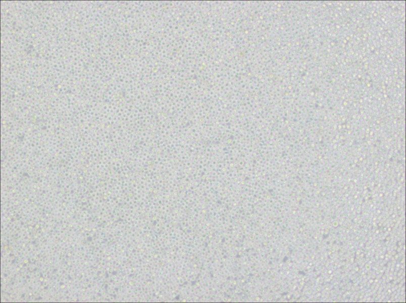 Ramos [RA 1] Cell Complete Medium - small - 4