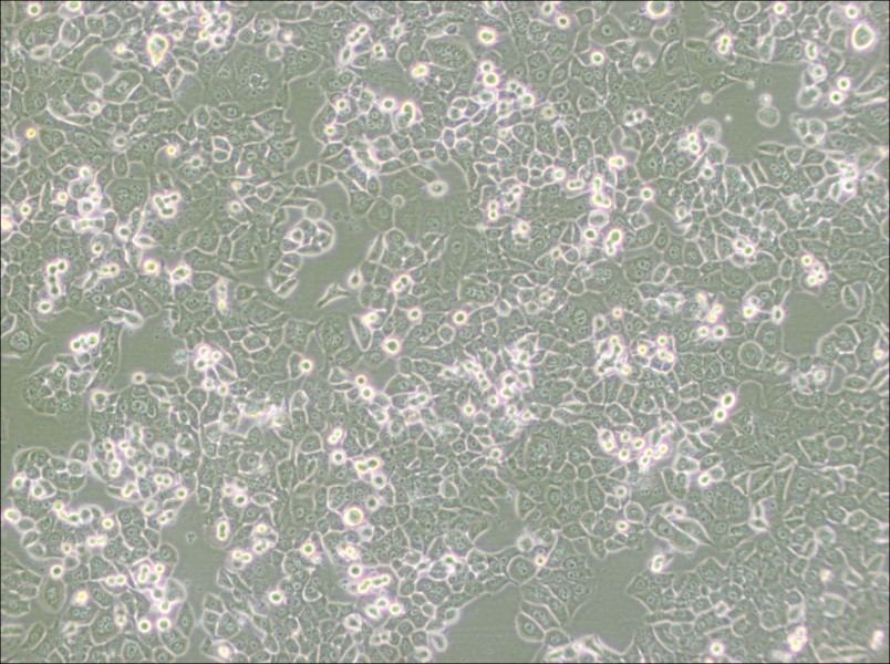 NCI-H2126 Cell Complete Medium - 3