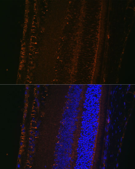 Immunofluorescence analysis of mouse eye using LOXL1 Polyclonal Antibody at dilution of 1:100 (40x lens). Blue: DAPI for nuclear staining.